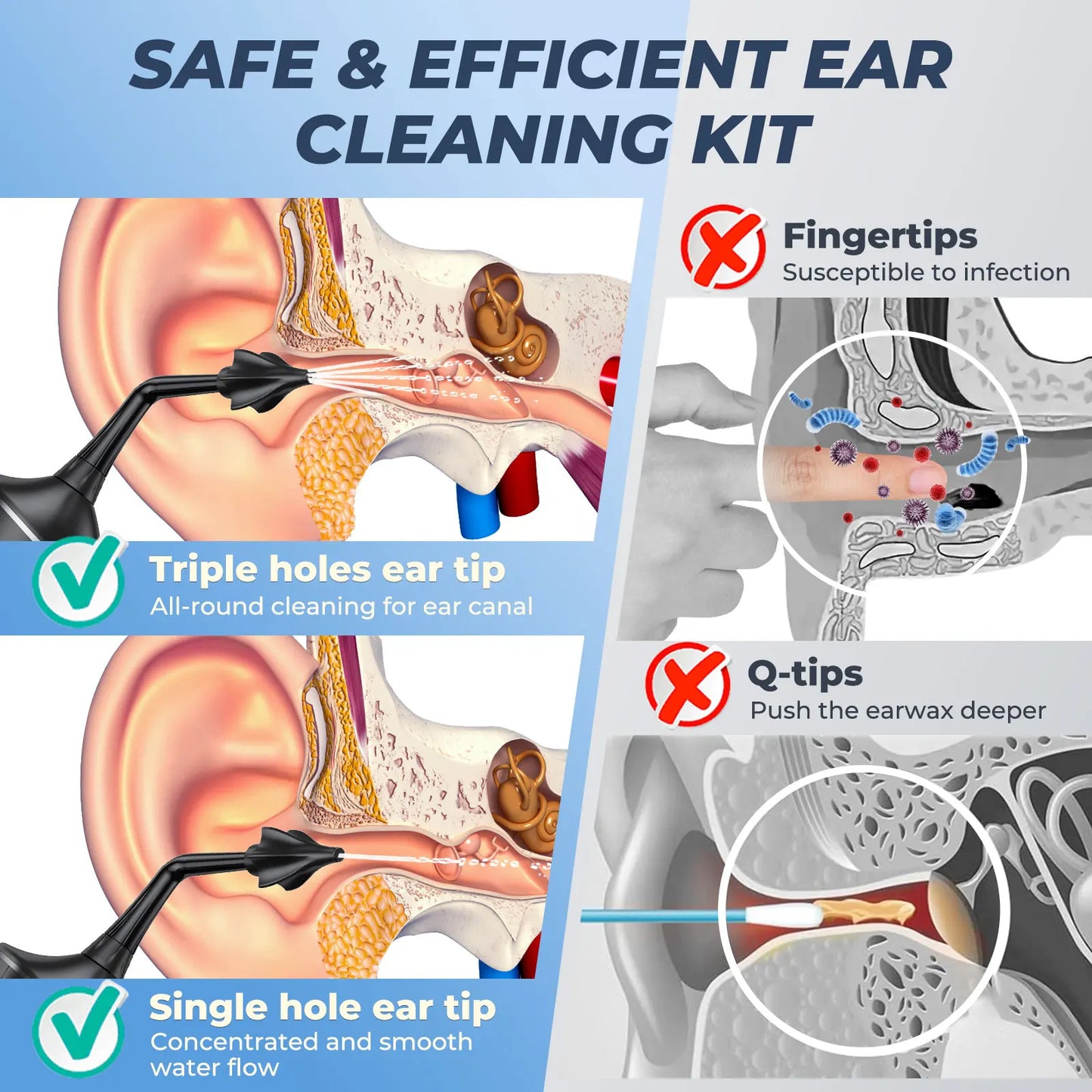 Electric earwax removal kit