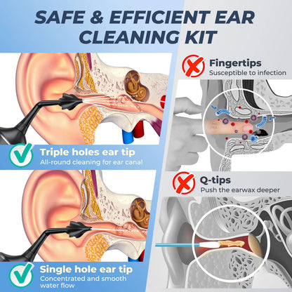 Electric earwax removal kit