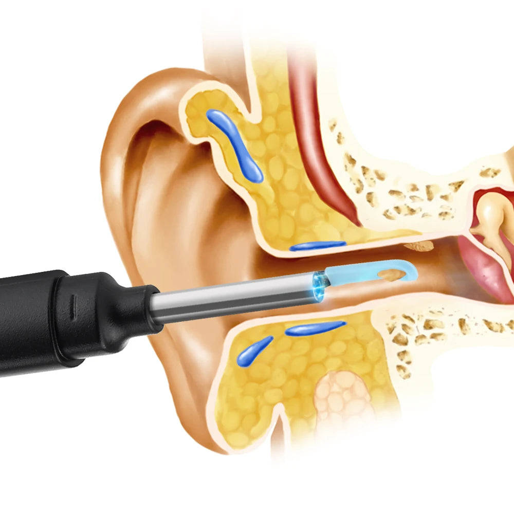 3.9mm smart visual ear cleaner