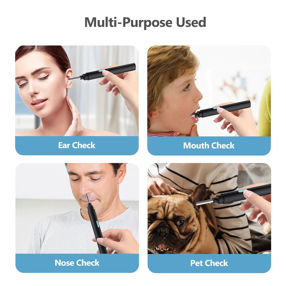 3.9mm smart visual ear cleaner