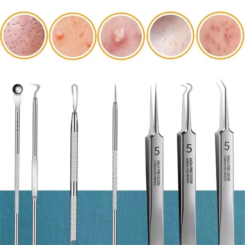 Acne Needle Blackhead Clip Remover